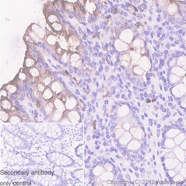 Immunohistochemistry (Formalin/PFA-fixed paraffin-embedded sections) - Anti-CEACAM6 antibody [1H7-4B] (AB254157)