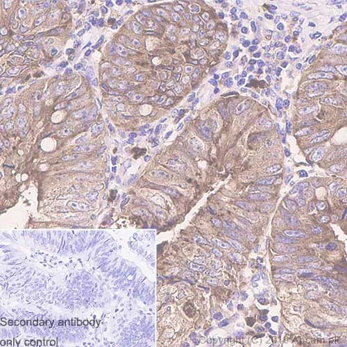 Immunohistochemistry (Formalin/PFA-fixed paraffin-embedded sections) - Anti-CEACAM6 antibody [1H7-4B] - BSA and Azide free (AB255910)