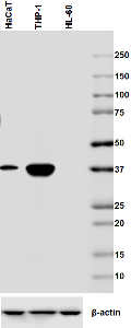 Western blot - Anti-CEACAM6 antibody [9A6] (AB78029), expandable thumbnail