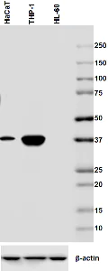 Western blot - Anti-CEACAM6 antibody [9A6] (AB78029)