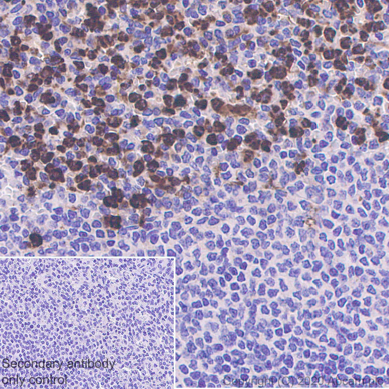 Immunohistochemistry (Formalin/PFA-fixed paraffin-embedded sections) - Anti-CEACAM6 antibody [EPR23956-80] - BSA and Azide free (AB275033)