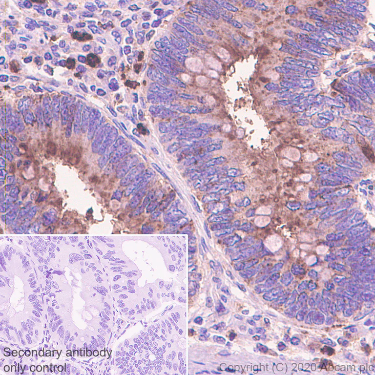 Immunohistochemistry (Formalin/PFA-fixed paraffin-embedded sections) - Anti-CEACAM6 antibody [EPR23956-80] - BSA and Azide free (AB275033)