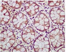 Immunohistochemistry (Formalin/PFA-fixed paraffin-embedded sections) - Anti-CEACAM6 antibody [EPR4403] - BSA and Azide free (AB235139)