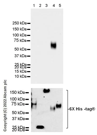 Western blot - Anti-CEACAM6 antibody [EPR4404(2)] (AB134058)