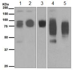 Western blot - Anti-CEACAM6 antibody [EPR4404(2)] - BSA and Azide free (AB248662)