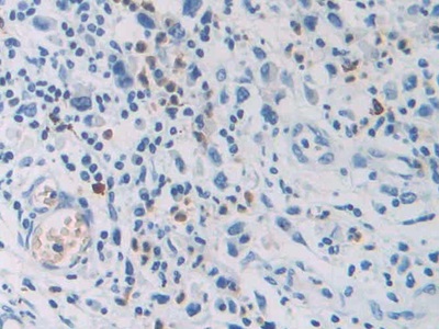 Immunohistochemistry (Formalin/PFA-fixed paraffin-embedded sections) - Anti-CEACAM7 antibody (AB232696)