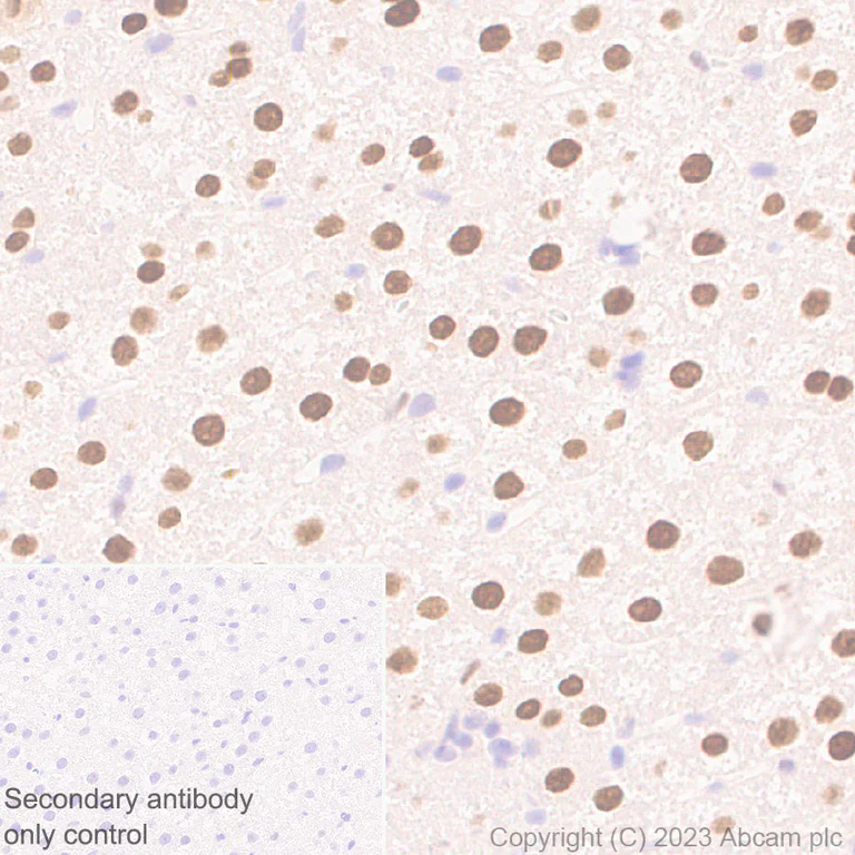 Immunohistochemistry (Formalin/PFA-fixed paraffin-embedded sections) - Anti-CEBP Alpha/CEBPA antibody [EPR27924-90] - BSA and Azide free (AB317443)
