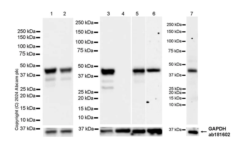 Western blot - Anti-CEBP Alpha/CEBPA antibody [EPR27924-90] - BSA and Azide free (AB317443)