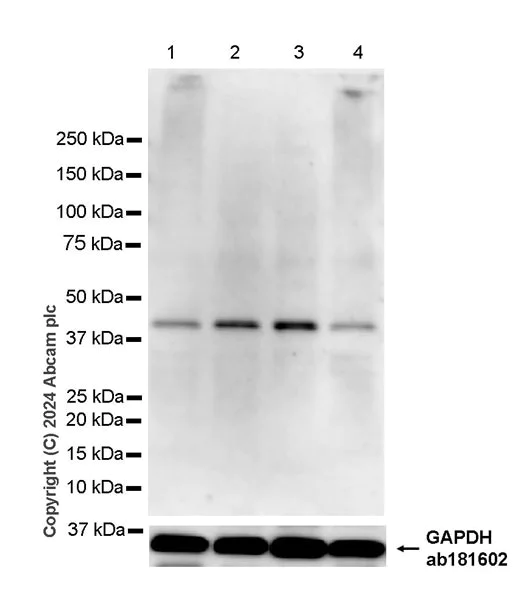 Western blot - Anti-CEBP Alpha/CEBPA antibody [EPR27924-90] - BSA and Azide free (AB317443)