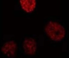 Immunocytochemistry/ Immunofluorescence - Anti-CEBP Beta antibody [1H7] (AB15050), expandable thumbnail