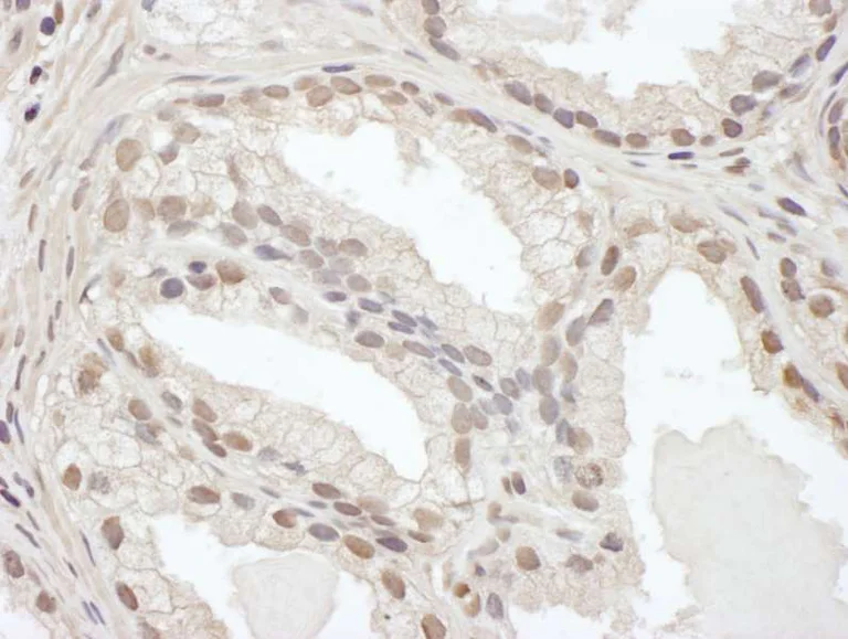 Immunohistochemistry (Formalin/PFA-fixed paraffin-embedded sections) - Anti-CEBP Beta antibody (AB264305)
