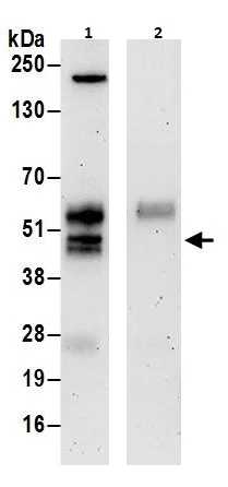 Immunoprecipitation - Anti-CEBP Beta antibody (AB264305)
