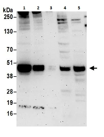Western blot - Anti-CEBP Beta antibody (AB264305)