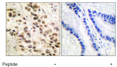Immunohistochemistry (Formalin/PFA-fixed paraffin-embedded sections) - Anti-CEBP Beta antibody (AB53138)