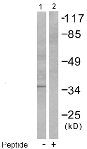 Western blot - Anti-CEBP Beta antibody (AB53138)
