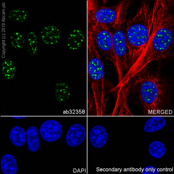 Immunocytochemistry/ Immunofluorescence - Anti-CEBP Beta antibody [E299] - BSA and Azide free (AB220813), expandable thumbnail