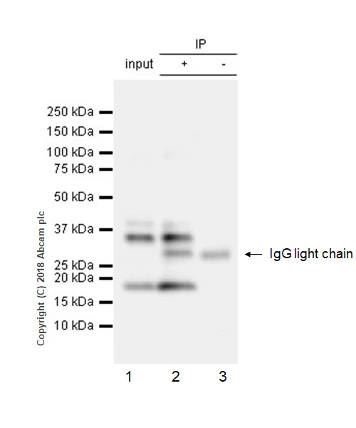 Immunoprecipitation - Anti-CEBP Beta antibody [E299] - BSA and Azide free (AB220813)