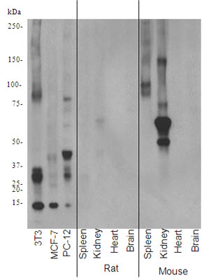 Western blot - Anti-CEBP Beta antibody [E299] - C-terminal (ab32358), expandable thumbnail