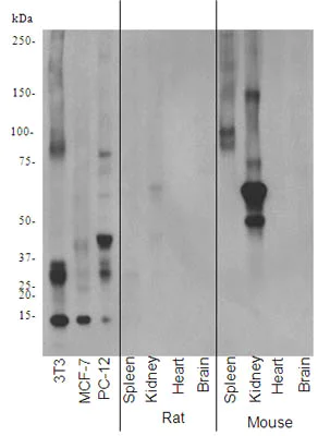 Western blot - Anti-CEBP Beta antibody [E299] - C-terminal (AB32358)