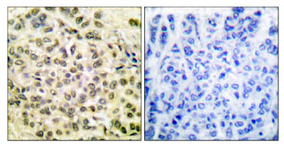 Immunohistochemistry (Formalin/PFA-fixed paraffin-embedded sections) - Anti-CEBP Beta (phospho T188 + T235) antibody (AB52194)