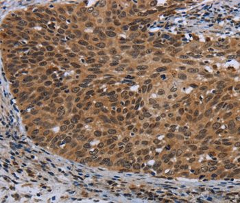 Immunohistochemistry (Formalin/PFA-fixed paraffin-embedded sections) - Anti-CEBP Delta/CEBPD antibody (AB198230)