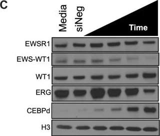 Western blot - Anti-CEBP Delta/CEBPD antibody (AB65081)