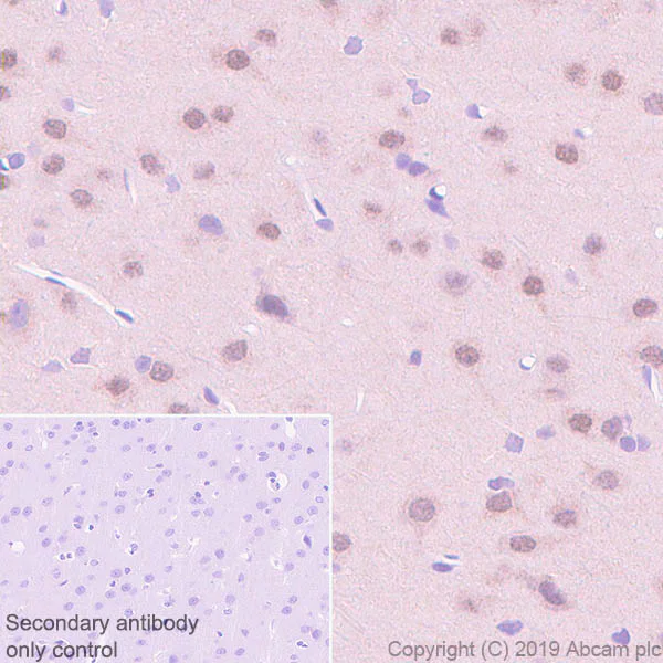 Immunohistochemistry (Formalin/PFA-fixed paraffin-embedded sections) - Anti-CEBP Delta/CEBPD antibody [EPR23518-259] (AB245214)