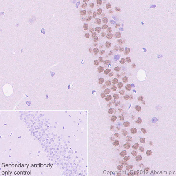 Immunohistochemistry (Formalin/PFA-fixed paraffin-embedded sections) - Anti-CEBP Delta/CEBPD antibody [EPR23518-259] (AB245214)