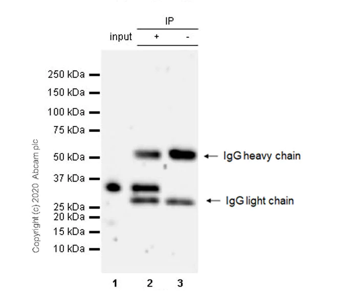 Immunoprecipitation - Anti-CEBP Delta/CEBPD antibody [EPR23518-259] (AB245214)