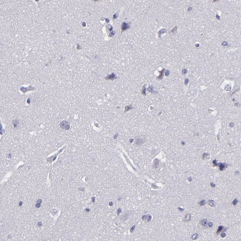 Immunohistochemistry (Formalin/PFA-fixed paraffin-embedded sections) - Anti-CEBPE antibody (AB246861)