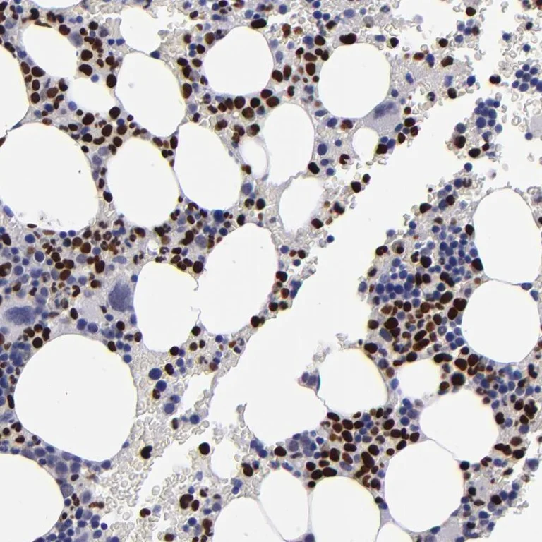 Immunohistochemistry (Formalin/PFA-fixed paraffin-embedded sections) - Anti-CEBPE antibody (AB246861)