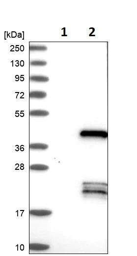 Western blot - Anti-CEBPE antibody (AB246861)
