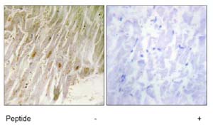 Immunohistochemistry (Formalin/PFA-fixed paraffin-embedded sections) - Anti-CEBPG antibody (AB74045)