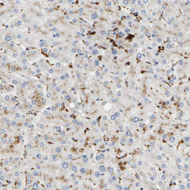 Immunohistochemistry (Formalin/PFA-fixed paraffin-embedded sections) - Anti-CECR1 antibody (AB246886)