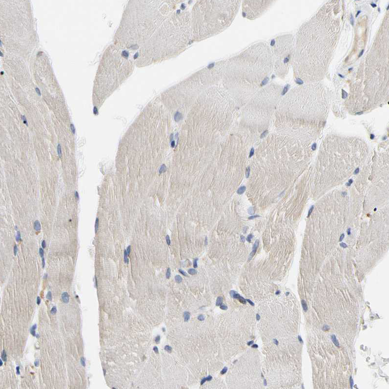 Immunohistochemistry (Formalin/PFA-fixed paraffin-embedded sections) - Anti-CECR1 antibody (AB246886), expandable thumbnail