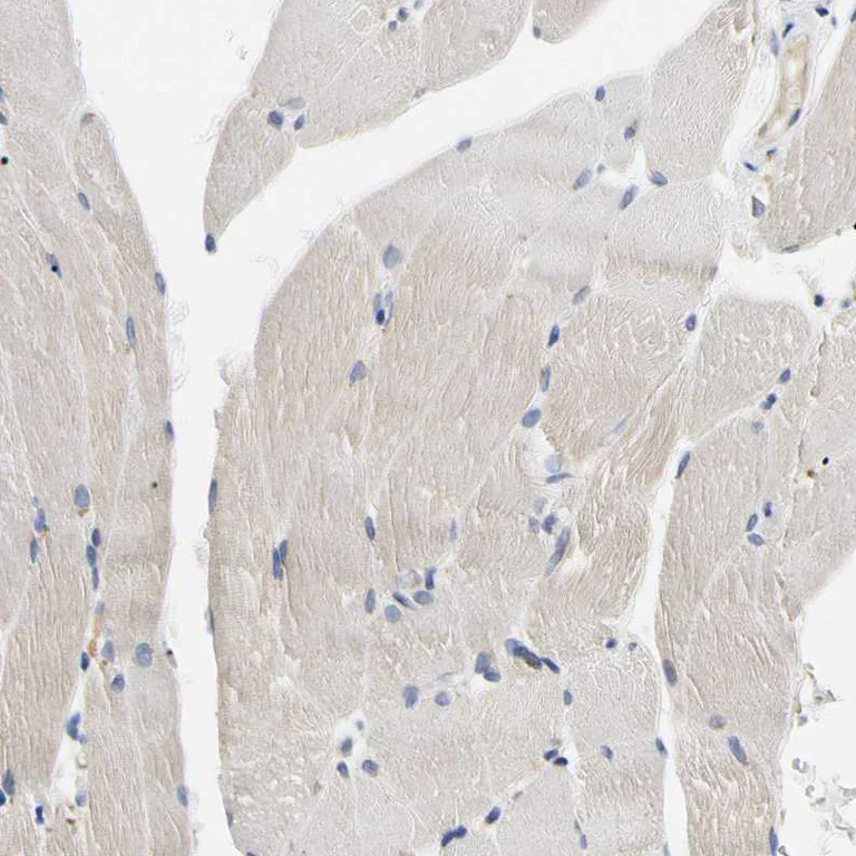 Immunohistochemistry (Formalin/PFA-fixed paraffin-embedded sections) - Anti-CECR1 antibody (AB246886)