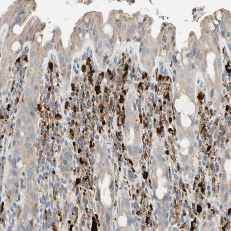 Immunohistochemistry (Formalin/PFA-fixed paraffin-embedded sections) - Anti-CECR1 antibody (AB246886)