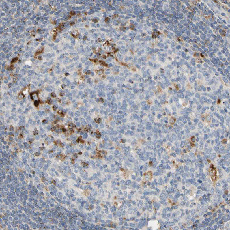 Immunohistochemistry (Formalin/PFA-fixed paraffin-embedded sections) - Anti-CECR1 antibody (AB246886), expandable thumbnail