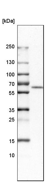 Western blot - Anti-CECR1 antibody (AB246886), expandable thumbnail