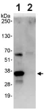 Immunoprecipitation - Anti-CEE antibody (AB93801)