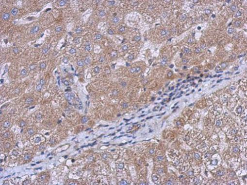 Immunohistochemistry (Formalin/PFA-fixed paraffin-embedded sections) - Anti-CEECAM1 antibody (AB227943), expandable thumbnail