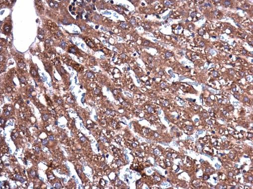 Immunohistochemistry (Formalin/PFA-fixed paraffin-embedded sections) - Anti-CEECAM1 antibody (AB227943), expandable thumbnail