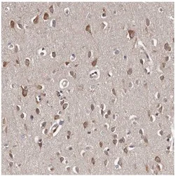 Immunohistochemistry (Formalin/PFA-fixed paraffin-embedded sections) - Anti-CELF3 antibody (AB121249)