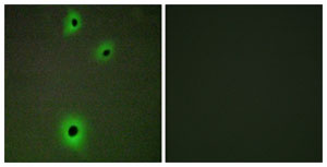 Immunocytochemistry/ Immunofluorescence - Anti-Cell adhesion molecule 4 antibody (AB139395)