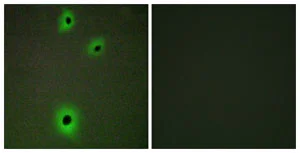 Immunocytochemistry/ Immunofluorescence - Anti-Cell adhesion molecule 4 antibody (AB139395)