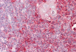 Immunohistochemistry (Formalin/PFA-fixed paraffin-embedded sections) - Anti-Cell adhesion molecule 4 antibody (AB139395)