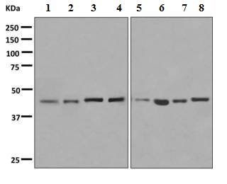Western blot - Anti-Cell adhesion molecule 4 antibody [EP9563] (AB150370), expandable thumbnail