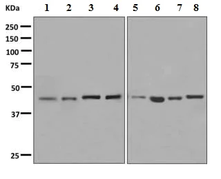 Western blot - Anti-Cell adhesion molecule 4 antibody [EP9563] (AB150370)