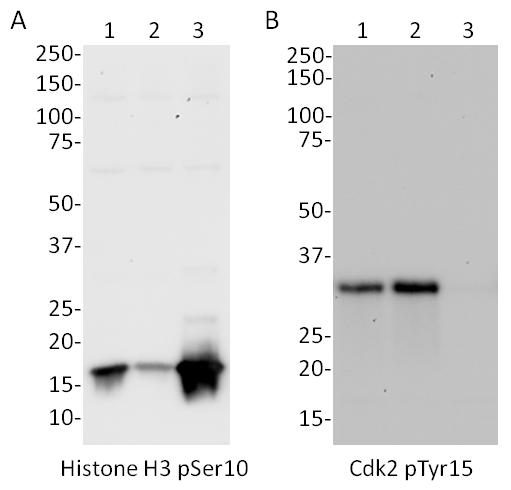 Élisaページ Cell Cycle In-Cell ELISA Kit (Fluorescent) (ab140363) | Abcam