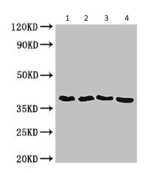 Western blot - Anti-Cell Division Protein FtsZ antibody (AB225991)